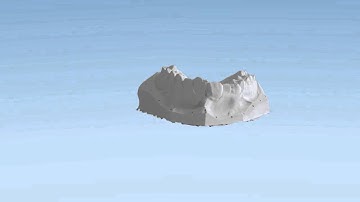 Oberkiefer Modell 3D Quick Scan 123D Catch