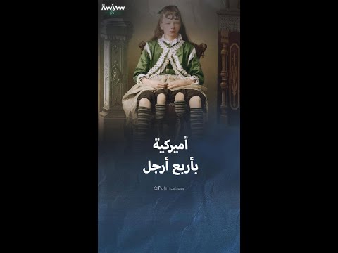 الأميركية جوزفين ميرتل ذات الأربع أرجل