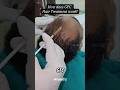 🤔 GFC Hair Treatment in Delhi - 📞08376927927 (Majestic Derma) #gfctherapy #gfctreatment #gfc