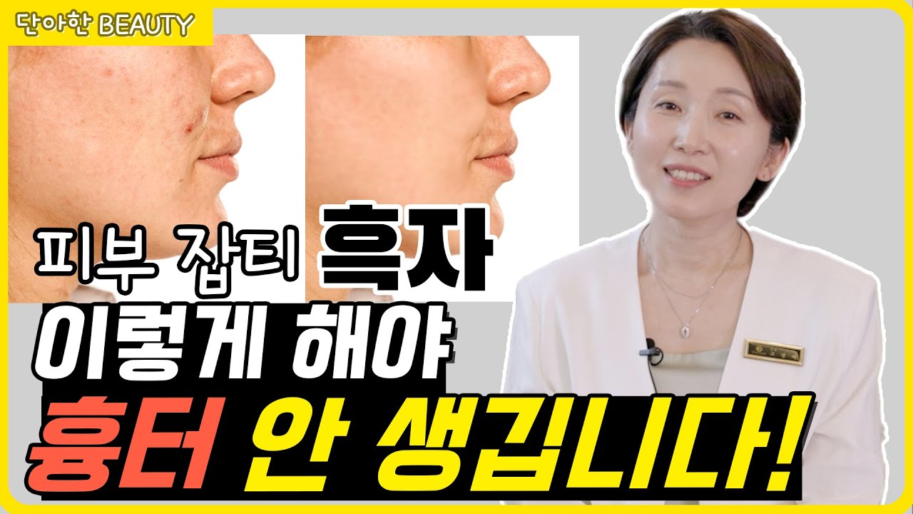 리팟 레이저로 흑자 고민은 이제 끝내세요. 기미는 토닝, 흑자는 리팟을 기억하세요. - YouTube