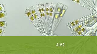 Tentang Alga, Bakteria dan Virus SAINS F5 KSSM BAB 1 MIKROORGANISMA Tentang Alga, Bakteria dan Virus SAINS F5 KSSM BAB 1 MIKROORGANISMA