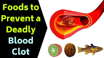Is coffee bad for blood clots?