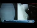 Jaipurdoorbeen hospital live stream