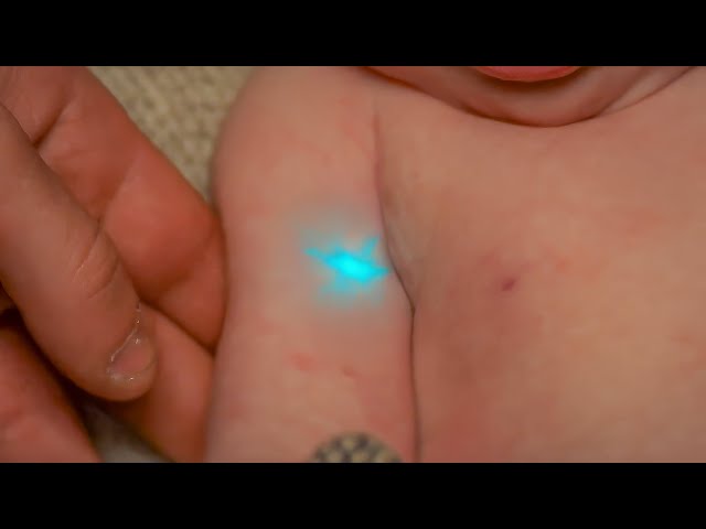 poor-baby-is-born-with-a-mysterious-mark-that-could-make-him-king