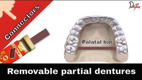 Remembering maxillary major connectors 🅴🅽🅶🅻🅸🆂🅷