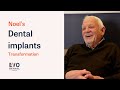 Noel's Dental Implants Journey - Smile In A Day