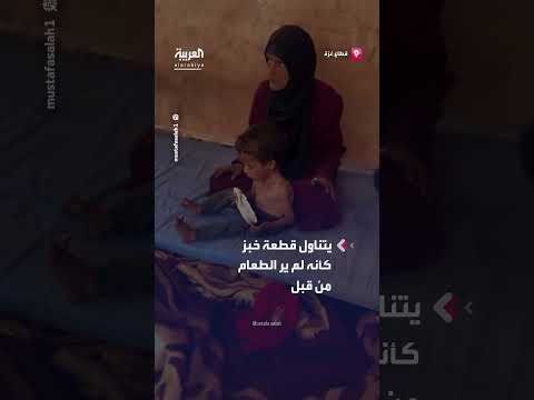 طفل فلسطيني في غزة يتناول الخبز للمرة الأولى بسبب سوء التغذية