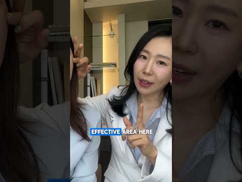 SMILELINES? What you CAN do! 😁 #treatments #koreanprocedures #kbeauty #plasticsurgery