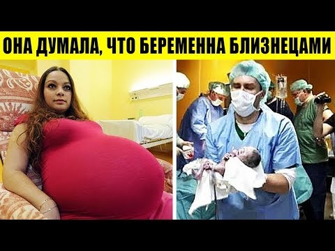 6 МАТЕРЕЙ, У КОТОРЫХ РОДЫ ПОШЛИ НЕ ПО ПЛАНУ
