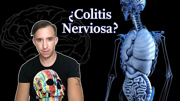 ¿Se siente cansado con la colitis?