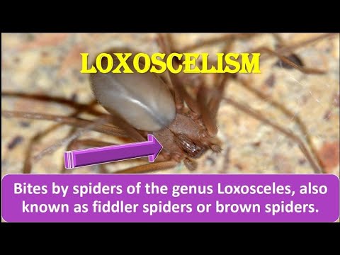 LOXOSCELISME: Bid af spillemandsedderkop eller brune edderkopper, behandling, tegn og symptomer.