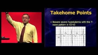 EEM 2019: Hypokalemia: You thought you knew how to recognize it