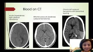 Basic Neuroimaging