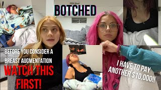 i got a boob job and was botched...(story time w/ footage)