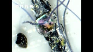 Harald Kautz - Vella Speaks Morgellons-Watch This video first Harald Kautz - Vella Speaks Morgellons-Watch This video first