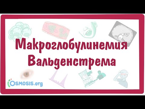 Макроглобулинемия Вальденстрема — причины, симптомы, патогенез, диагностика, лечение