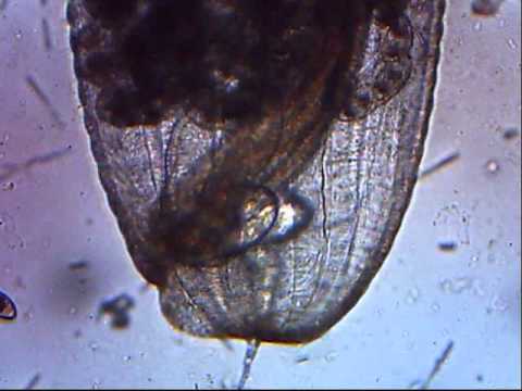 Pinworm - YouTube
Pinworm Eggs In Poop