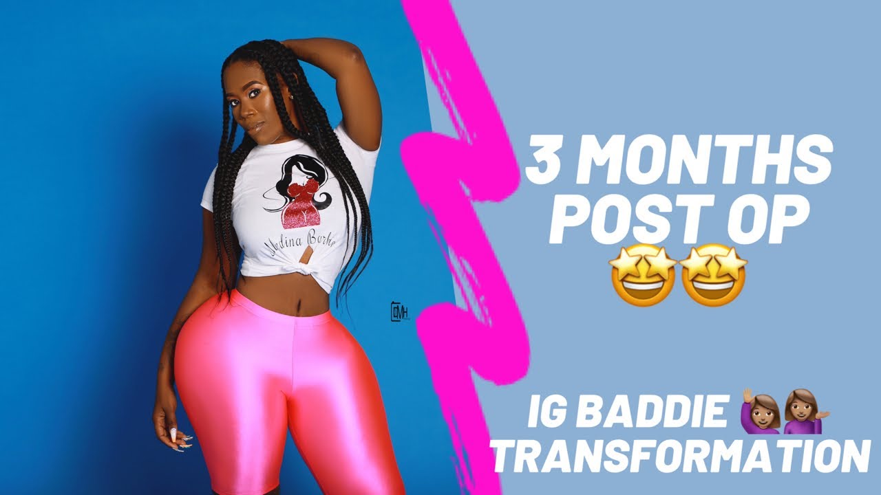 3 Months Post BBL n Tummy Tuck | Instagram Baddie Transformation ...