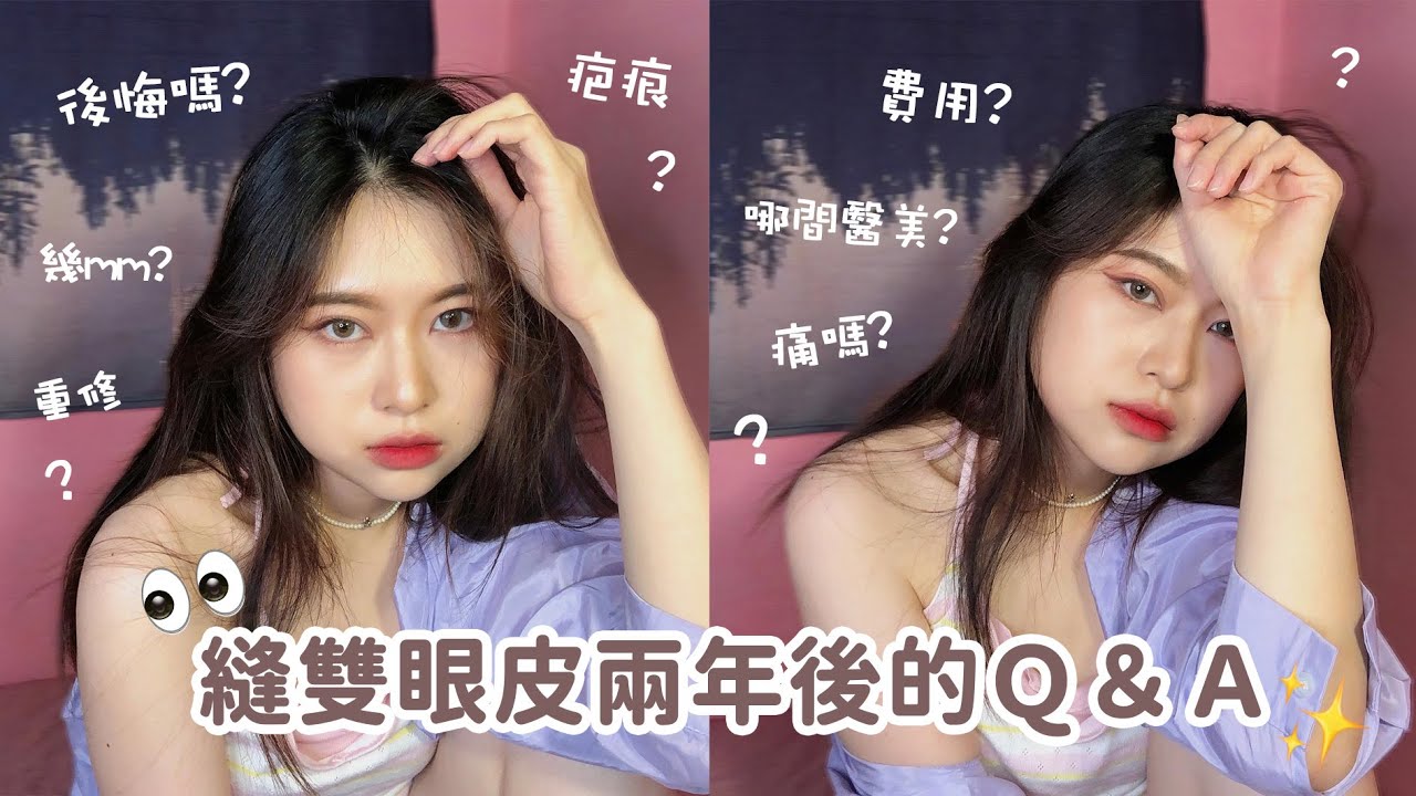 縫雙眼皮兩年後的Q&A👀我後悔嗎？診所費用公開！各種手術問題～【Angel蓁蓁 】