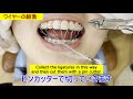 【Orthodontics】Wire replacement procedure in orthodontic treatment |歯列矯正|ワイヤー交換の処置