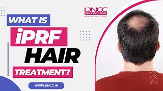 iPRF Treatment for Hair Growth, Injectable Platelet Rich Fibrin (iPRF) Treatment in India | DNCC iPRF Treatment for Hair Growth, Injectable Platelet Rich Fibrin (iPRF) Treatment in India | DNCC