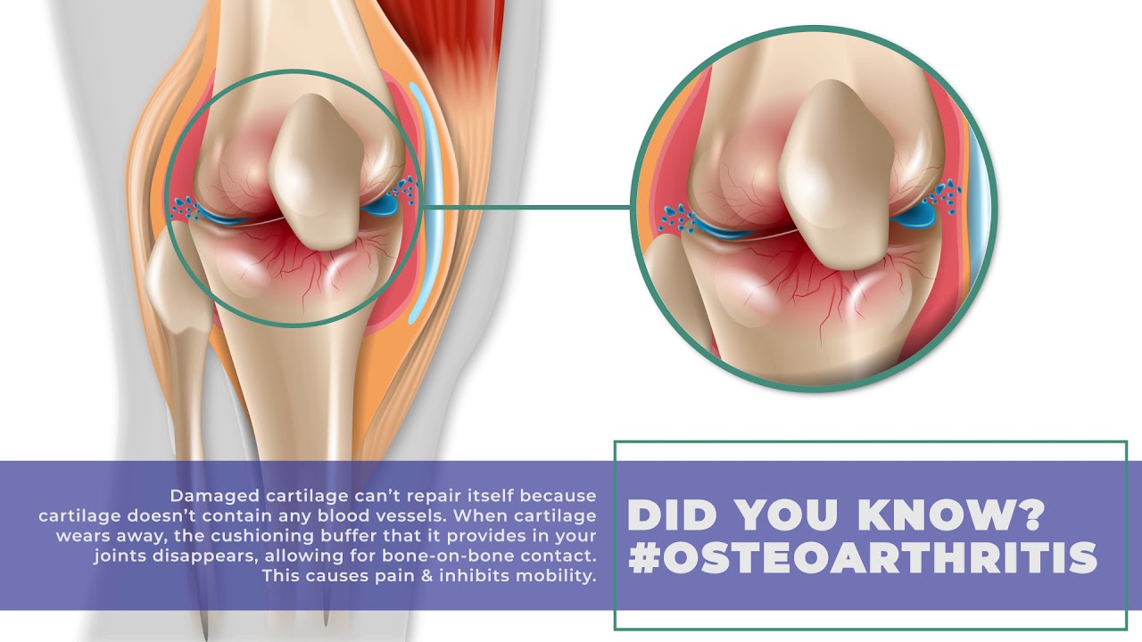 About Damaged Cartridge YouTube
