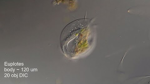 Euplotes at 10 and 40x DIC