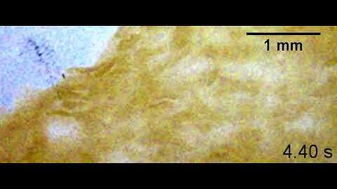 NeuroParticle - Tissue particles