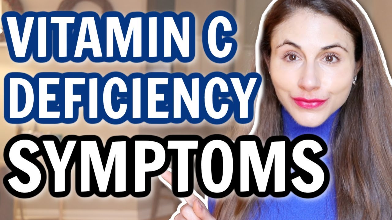 Vitamin C Deficiency Symptoms Drdrayzday Youtube