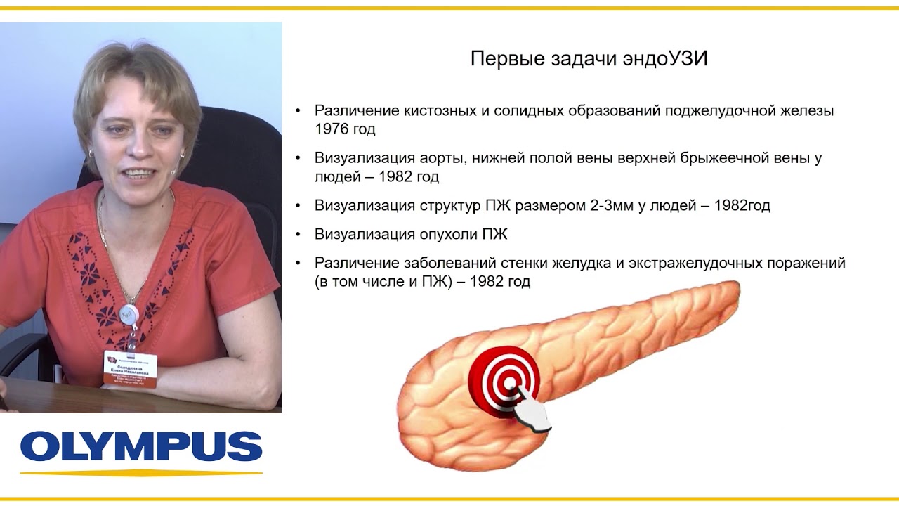 Метод эндосонографии. Методика выполнения и основные ориентиры. Е. Н. Солодинина