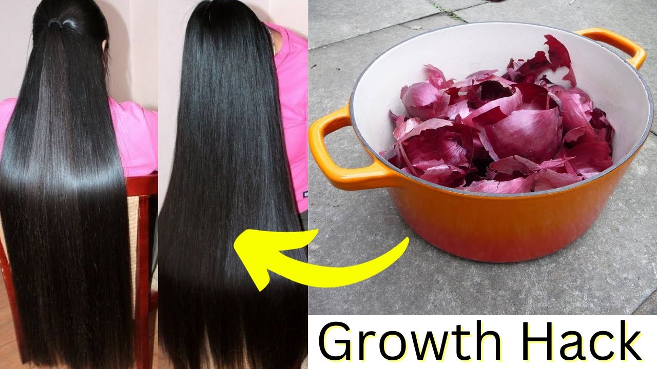 Onion peel for hair growth Pyaz ke chilke se baal lambe karne ka