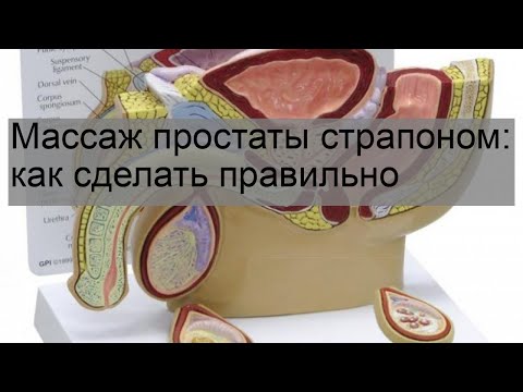 Массаж простаты страпоном: как сделать правильно