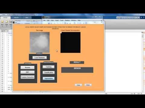 SHAPE HISTOGRAM BREAST CANCER DIAGNOSIS matlab projects