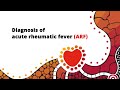 Diagnosis of acute rheumatic fever