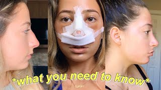Nose Job Tips *NO ONE* Tells You | 6 MONTH RHINOPLASTY UPDATE