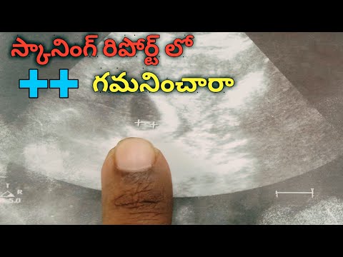 స్కాన్ నివేదిక lo ++ | స్కాన్ నివేదికలు lo ++ లేదా xy | స్కానింగ్ రిపోర్ట్ లో ++ ని గమనించారా