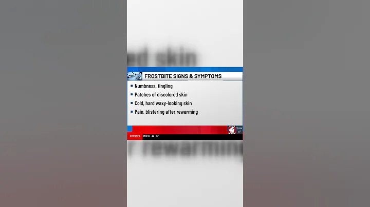 Doctors detail warning signs of frostbite, hypothermia