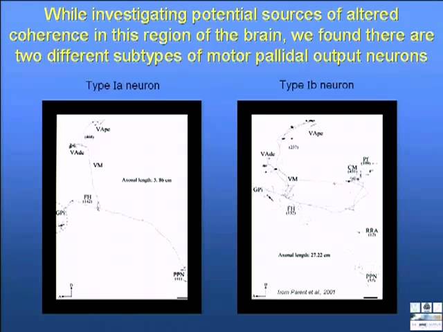 Anne Blood - Understanding the puzzle of motor control: A systems level approach