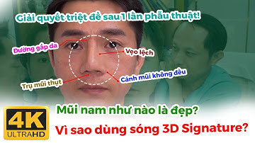 Sửa Mũi Hỏng Sau 2 Lần Thất Bại Bác Sĩ Huy Cứu Mũi Nam Giới Bằng Sóng 3D Signature