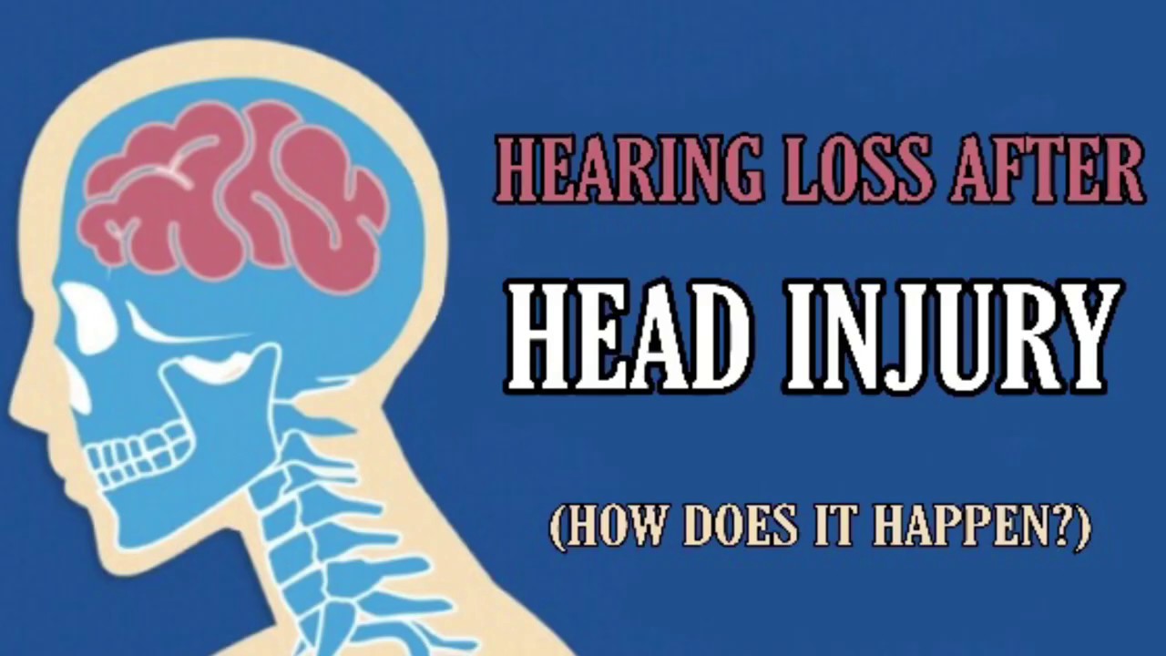 Hearing Loss After Head Injury | Datbraindoe - YouTube