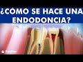 ¿Qué es una Endodoncia? - Tratamiento de conductos o desvitalización del diente paso a paso ©