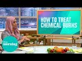 Dr Nighat&#39;s Advice on How to Treat Burns and Scalds | This Morning