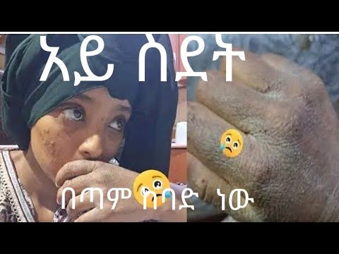 አይ ስደት በጣም ከባድ ነው 