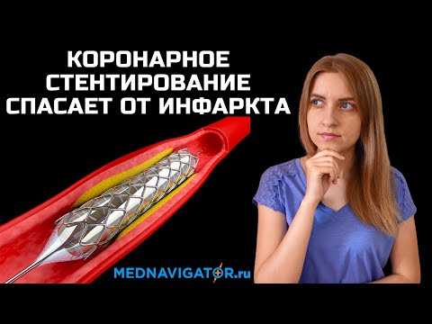 Коронарное стентирование лечит ишемическую болезнь и спасает от инфаркта миокарда | Mednavigator.ru