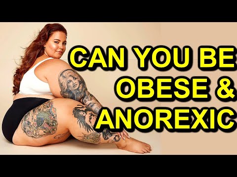 Is Tess Holliday ANOREXIC & Morbidly OBESE & MALNOURISHED??? What is Atypical Anorexia Nervosa???