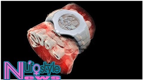 CERN chip enables first 3D color X-ray images of the human body