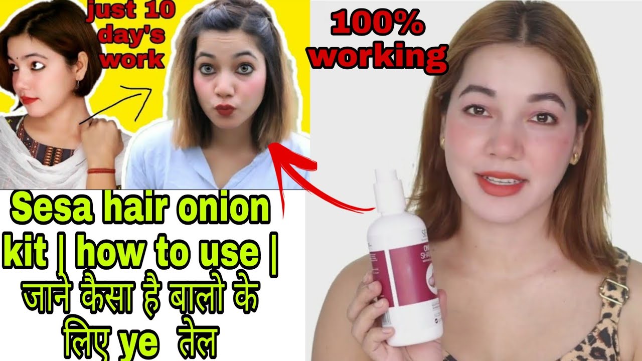 Sesa hair onion kit how to use जाने कैसा है बालो के लिए ye तेल Sesa Hair oil 30 days