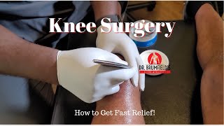 Information Knee Surgery Gone Wrong This Changed Everything Guide