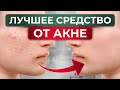 Фотодинамическая ТЕРАПИЯ / НОВЫЙ метод в лечении акне и гиперпигментации