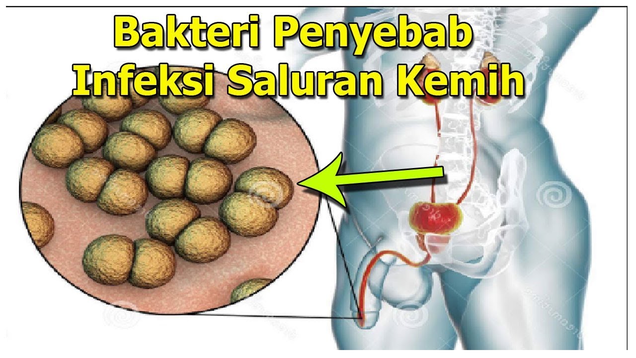 Cara Membasmi Bakteri Penyebab Infeksi Saluran Kemih